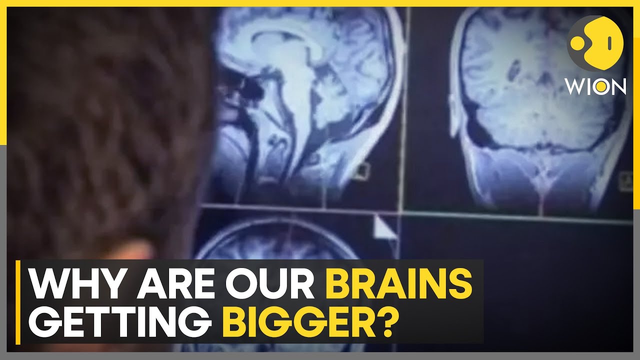 Brain size steadily increased for people born after 1930s | World News | WION - WION