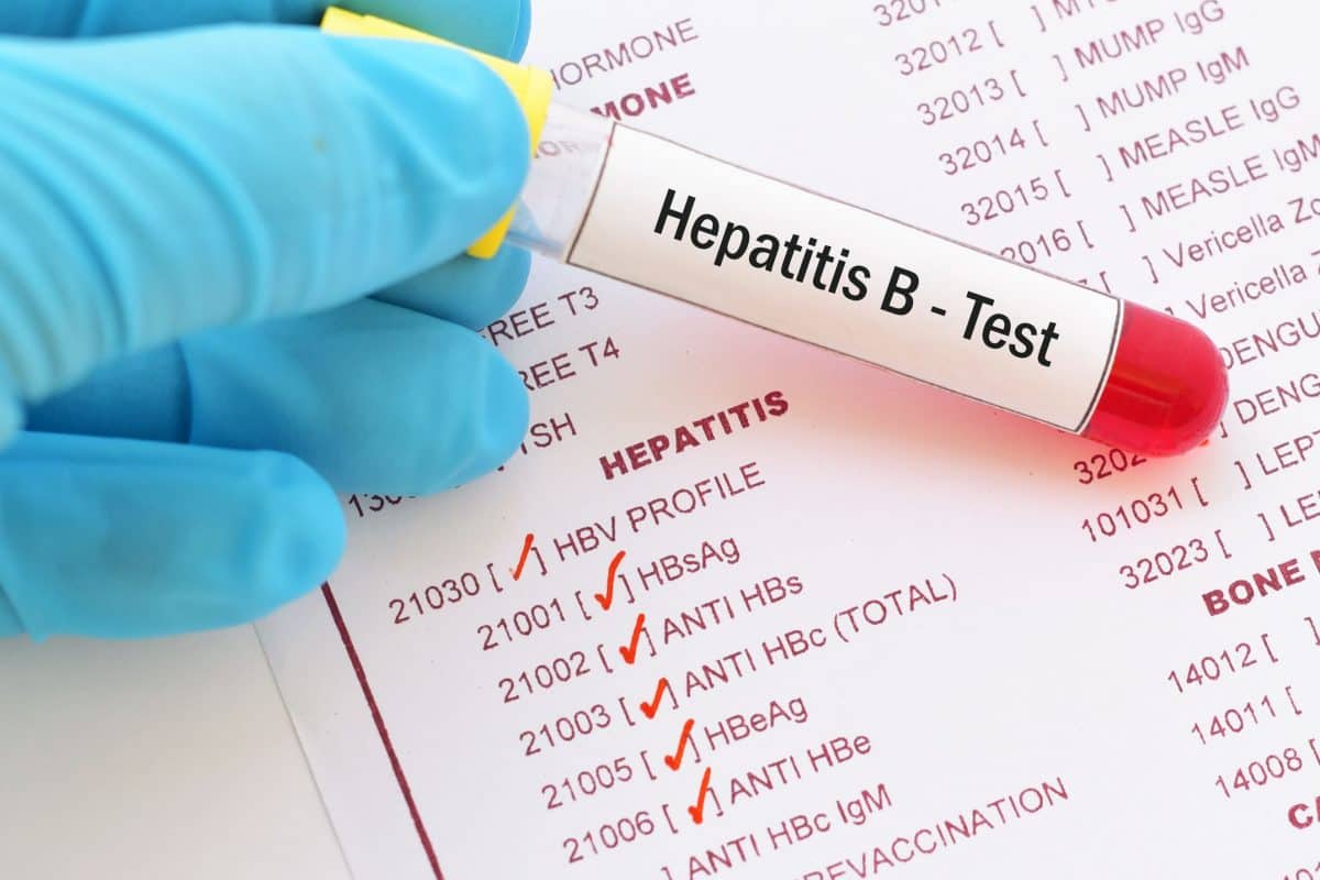 World Liver Day: Prioritizing Viral Hepatitis Screening With Comprehensive Testing | TheHealthSite.com - TheHealthSite