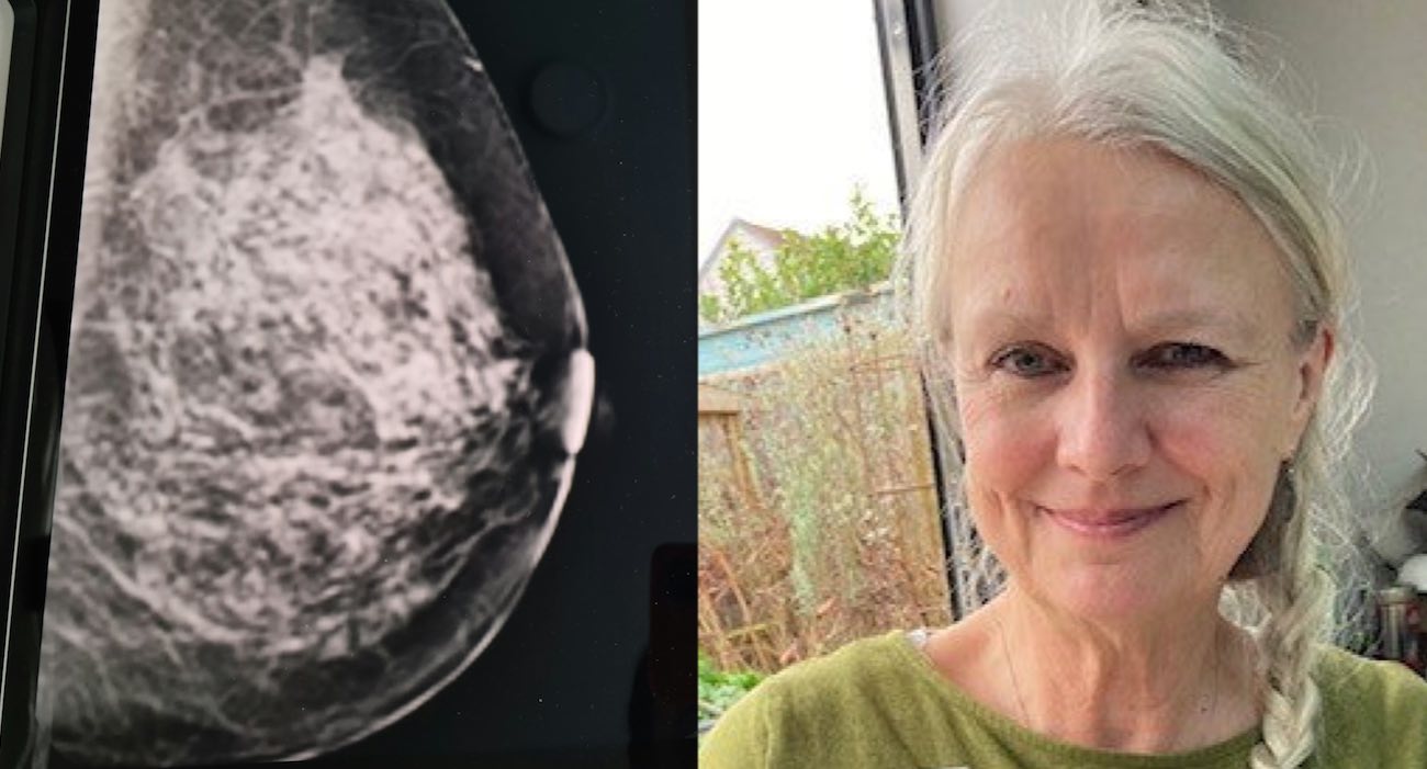 AI Detected Her Early Breast Cancer After Annual Test Came Back as Normal: ‘I feel so lucky’ - Good News Network