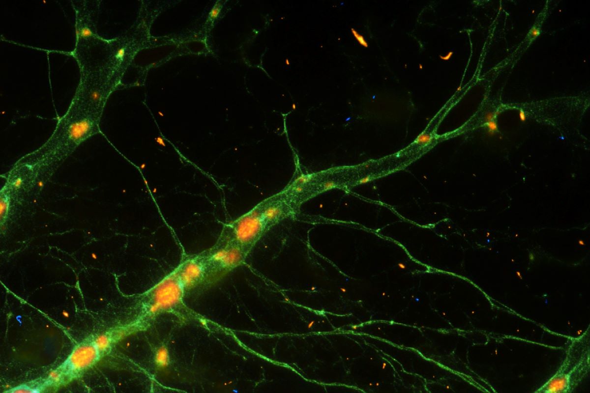 Reprogrammed Brain Cells Could Restore Damaged Circuits - Neuroscience News