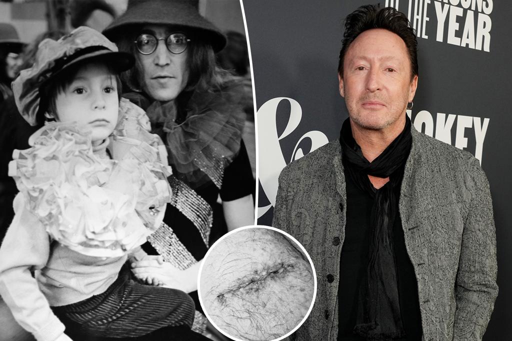 John Lennon’s son Julian, 61, reveals second cancer scare: ‘Fingers crossed’ - New York Post 